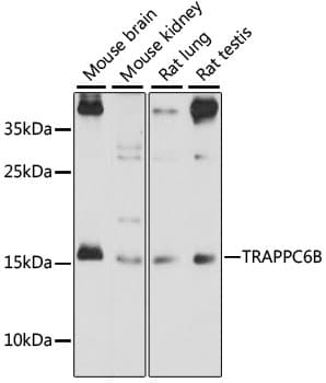 TRAPPC6B Antibody