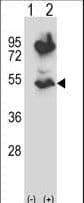 HTRA2 / OMI Antibody (aa73-102)