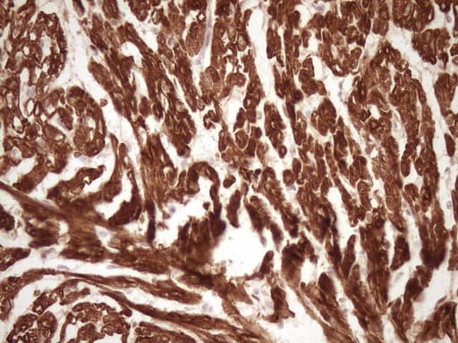 TNNI3 / Cardiac Troponin I Antibody (clone OTI3H9, Carrier-free)