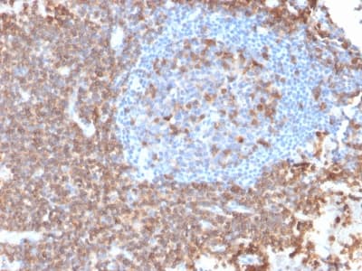 SPN / CD43 Antibody (clone rSPN/839)