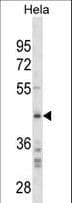 Osteonectin / SPARC Antibody (aa224-251)