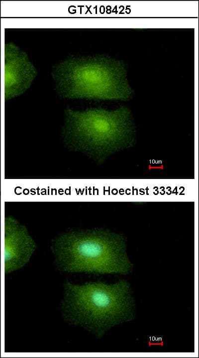 Polyclonal Rabbit anti-Human IL16 Antibody (aa1268-1332, WB)