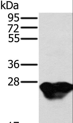 Polyclonal Rabbit anti-Human MYL3 Antibody (IHC, WB)