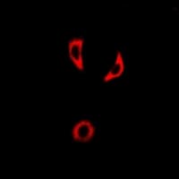 IL18BP Antibody