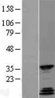 QKI Protein (Over-Expression Lysate Myc-DDK (Flag))