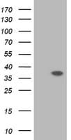 RASSF1 / RASSF1A Antibody (clone OTI8E2)