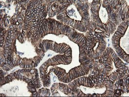 SLA2 / SLAP2 Antibody (clone OTI3A7)