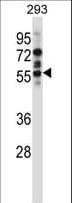 CAMK2D / CaMKII Delta Antibody (aa221-250)