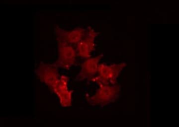 TPD52L2 / HD54 Antibody