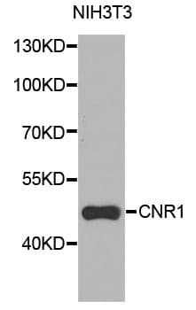 IHC-plus™ Polyclonal Rabbit anti-Human CNR1 / CB1 Antibody (IHC, WB)