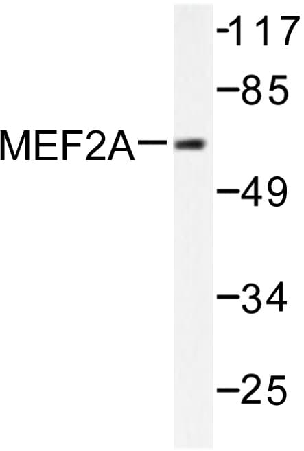 MEF2A / MEF2 Antibody (Ala306)