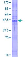 Human CLDN10 / Claudin 10 Protein (Recombinant GST)