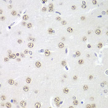 PRMT5 Antibody