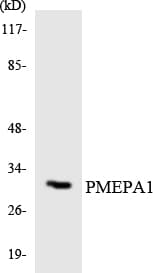 TMEPAI / PMEPA1 Antibody (aa75-124)