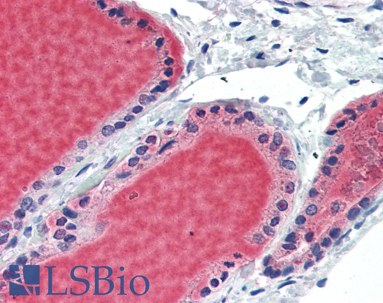 BCL6 Antibody (Internal)