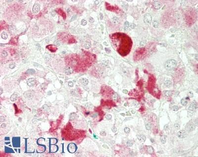IHC-plus™ MGP / Matrix Gla-Protein Antibody