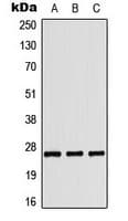 Polyclonal Rabbit anti-Human COL4A3 / Tumstatin Antibody (C-Terminus, WB)