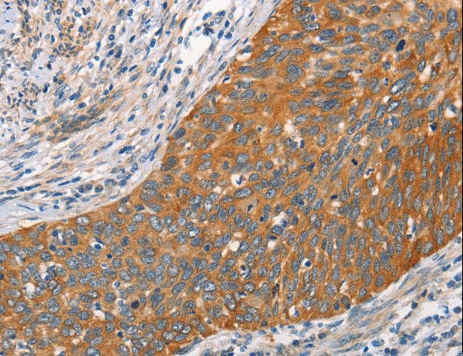 HSPB8 / H11 / HSP22 Antibody