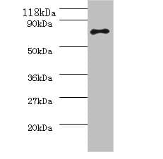 ureB / Urease Beta Antibody