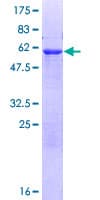 Human ADPRHL2 Protein (Recombinant GST)