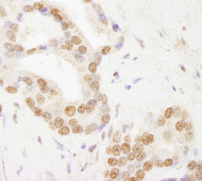 Polyclonal Rabbit anti-Human TAFII70 / TAF6 Antibody (aa627-677, IHC, WB)