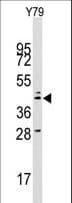 LAMP2 / CD107b Antibody (aa385-410)