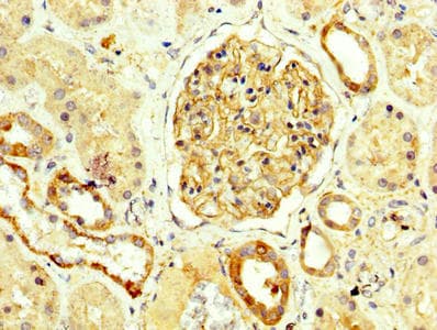 NPHS1 / Nephrin Antibody (aa23-257)