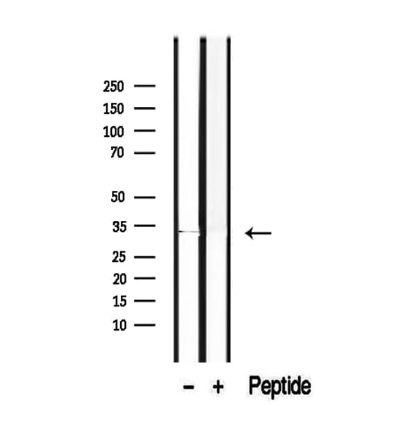 Polyclonal Rabbit anti-Human ROGDI Antibody (IHC, WB)