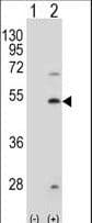 FDFT1 / Squalene Synthase Antibody (aa140-170)