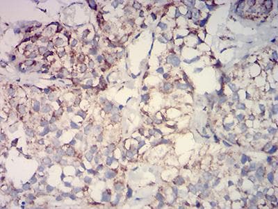 IDH2 Antibody (clone 3E8E9)