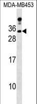 LIN7A Antibody (aa180-207)