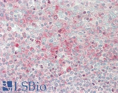 IHC-plus™ RPS4X + RPS4Y1 + RPS Antibody (aa214-263)