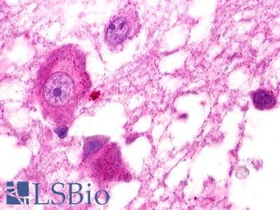 PathPlus™ GPR25 Antibody (C-Terminus)