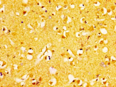 EPHA6 / EPH Receptor A6 Antibody