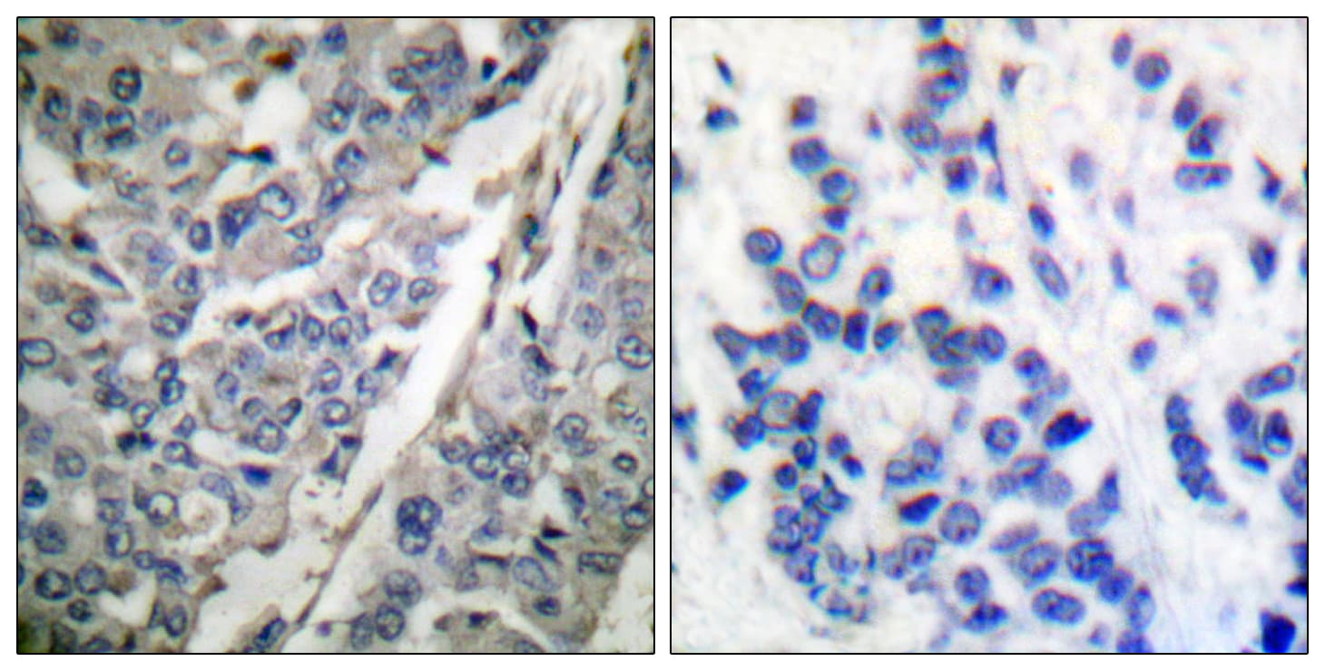 Polyclonal Rabbit anti-Human SYT1 / Synaptotagmin Antibody (phospho-Thr202, IHC, WB)