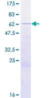 Human QKI Protein (Recombinant GST)