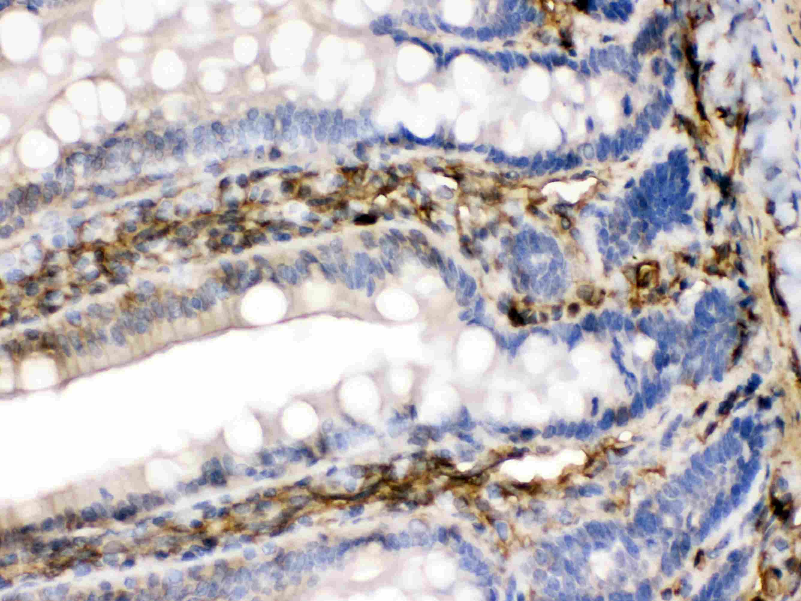 FGF1 / Acidic FGF Antibody
