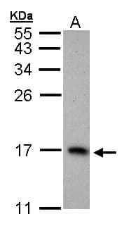 Polyclonal Rabbit anti-Human PTS Antibody (aa1-145, IHC, WB)