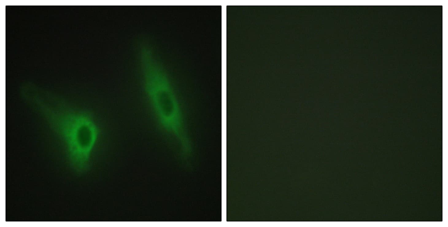 IHC-plus™ Polyclonal Rabbit anti-Human CSNK1E / CK1 Epsilon Antibody (aa276-325, IHC, IF, WB)