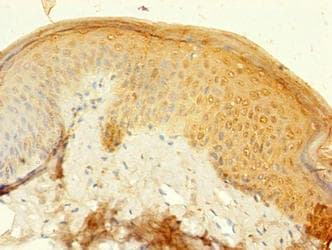 Polyclonal Rabbit anti-Human KRT77 / Keratin 77 / KRT1B Antibody (aa1-578, IHC)