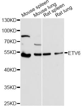 ETV6 / TEL Antibody