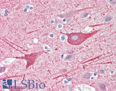 IHC-plus™ TUBA1A / Tubulin Alpha 1a Antibody