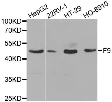 F9 / Factor IX Antibody