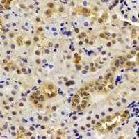 DDX1 Antibody
