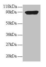 Polyclonal Rabbit anti-Human CXCL5 Antibody (WB)