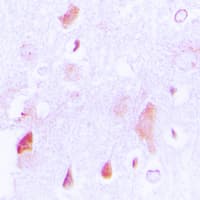 Polyclonal Rabbit anti-Human HCCS Antibody (Internal, IHC, IF, WB)
