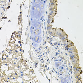 ATP1B1 Antibody