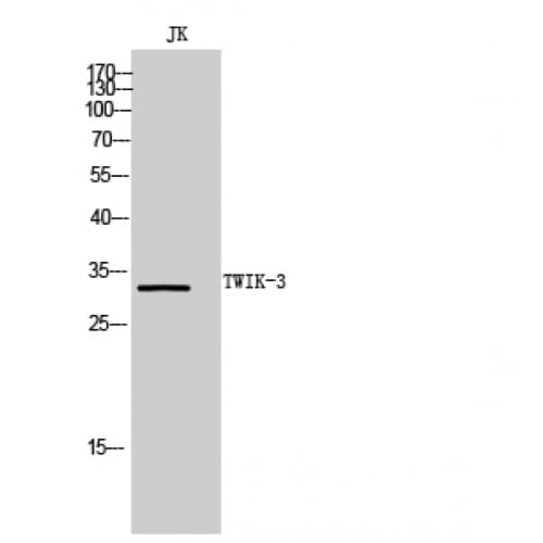 KCNK7 / K2p7.1 Antibody (170-250 aa, C-terminal)