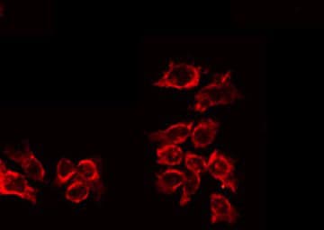 IL10RA Antibody (phospho-Tyr496)