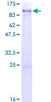 Human USP28 Protein (Recombinant GST)
